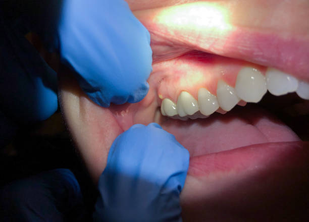 Best Pediatric Emergency Dentist in Bristol, VA